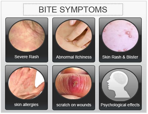 Bed Bug Bite Symptoms What Bedbug Bites Look Like